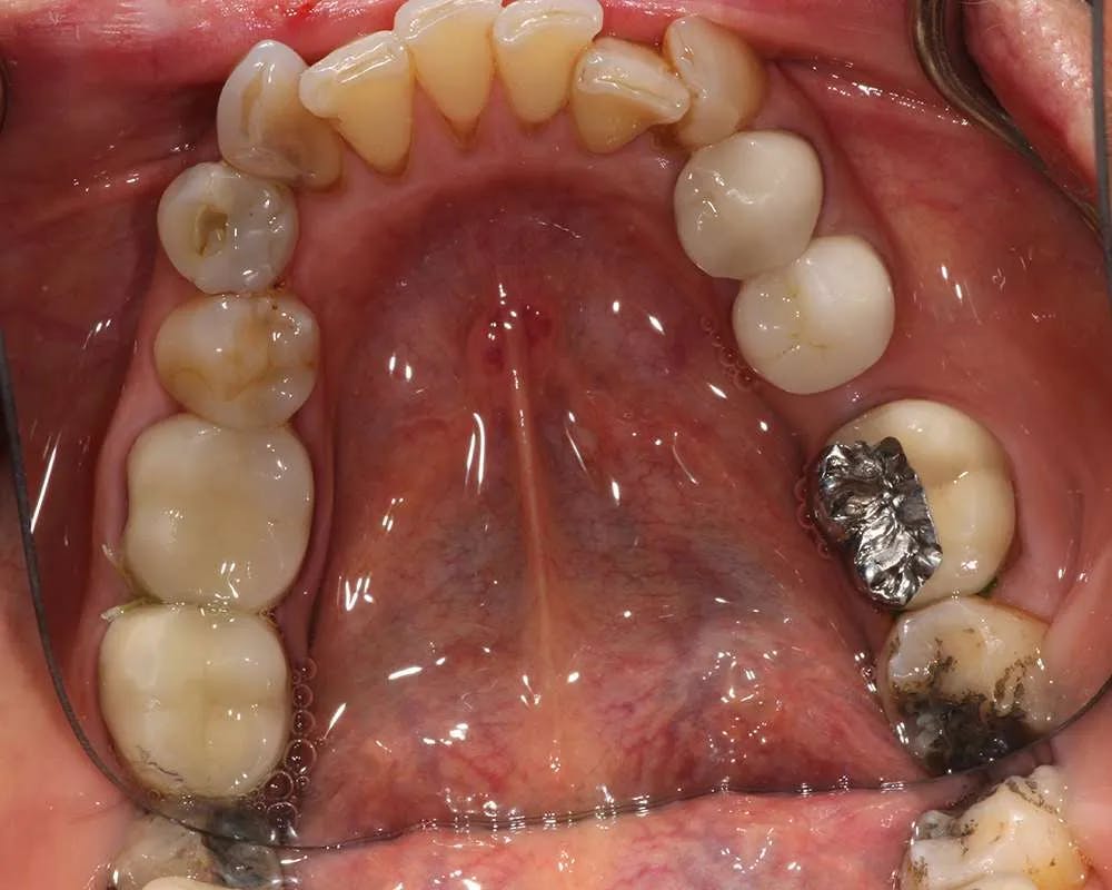 Patient 7 before and after image 1