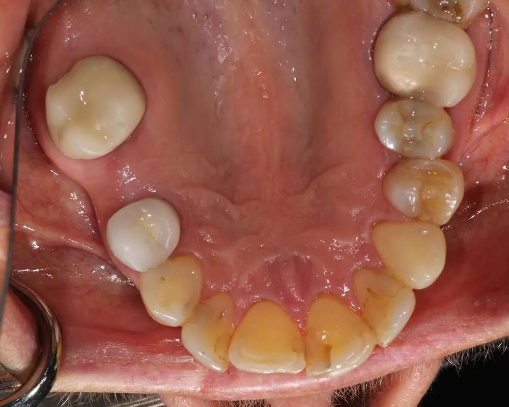 Patient 7 before and after image 2