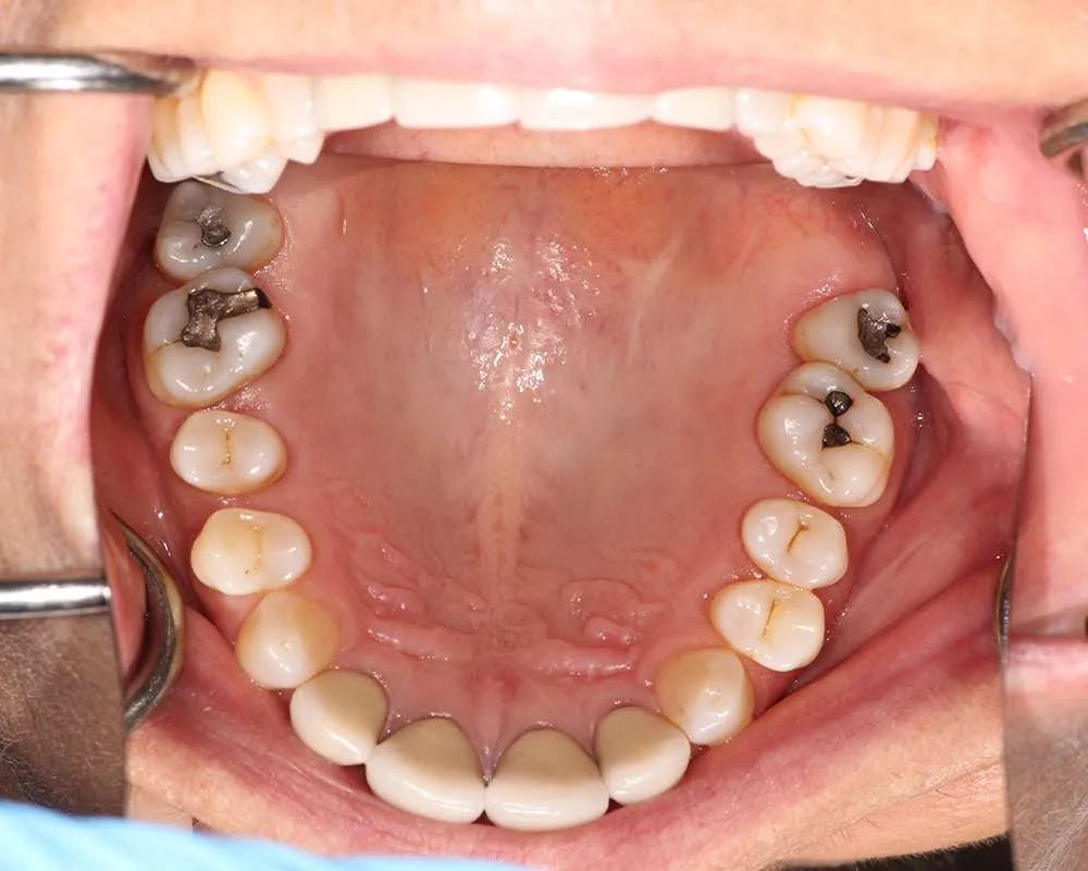 Patient eight before and after image 1