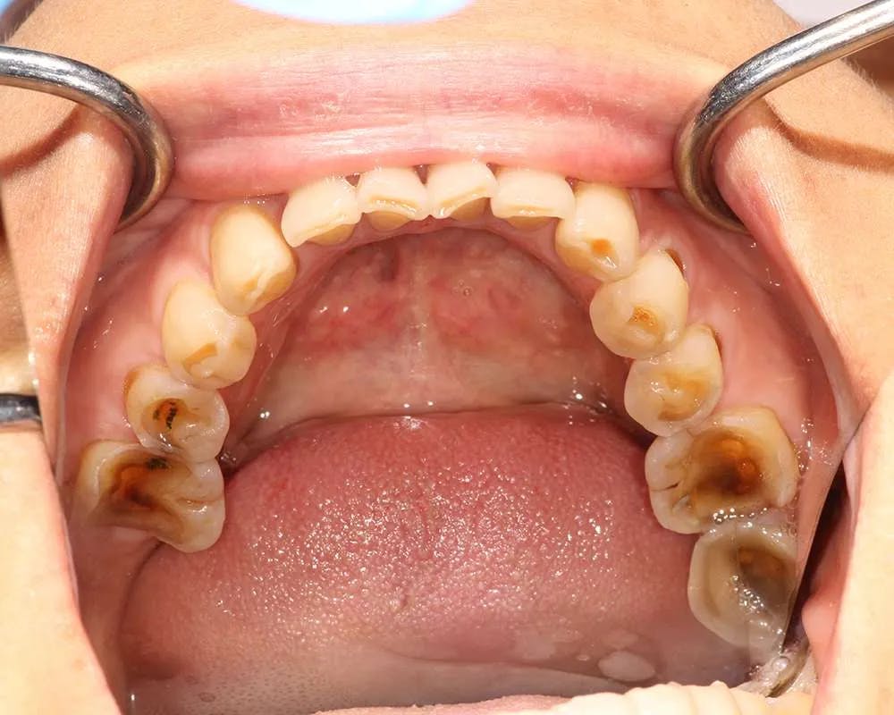 Patient nine before and after image 2