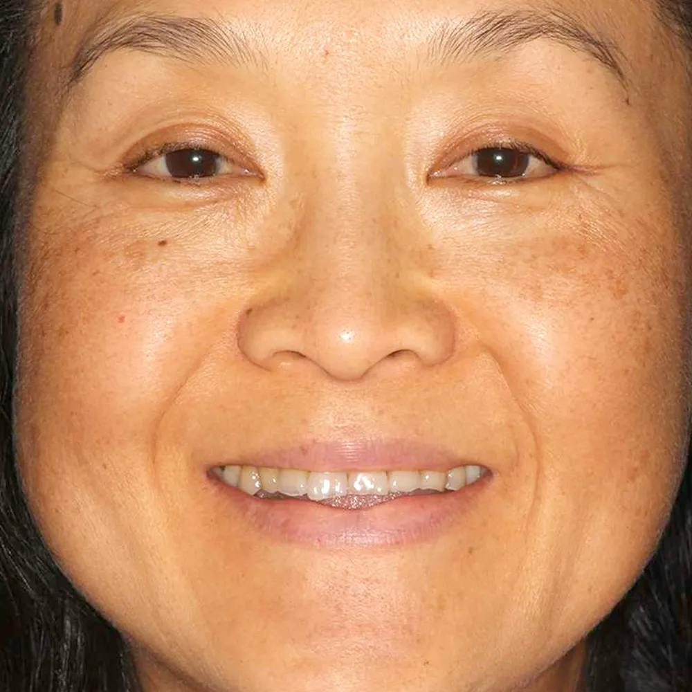 Patient nine before image