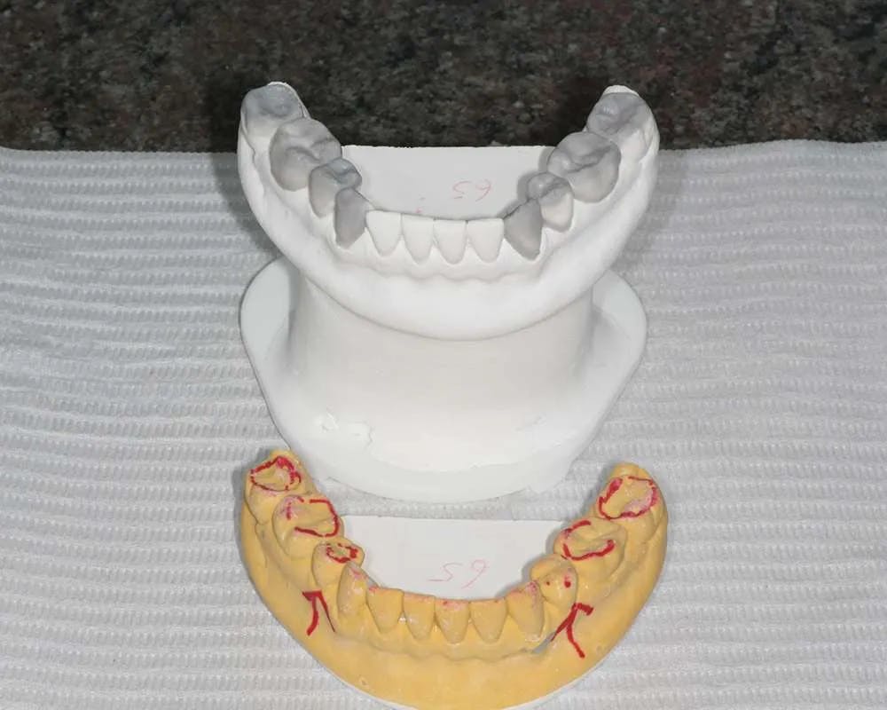 Patient ten before and after image 2