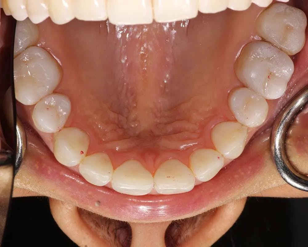 Patient ten before and after image 3