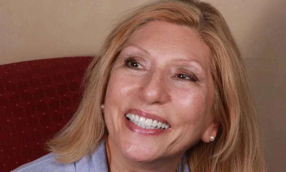 Patient eleven before and after image 4