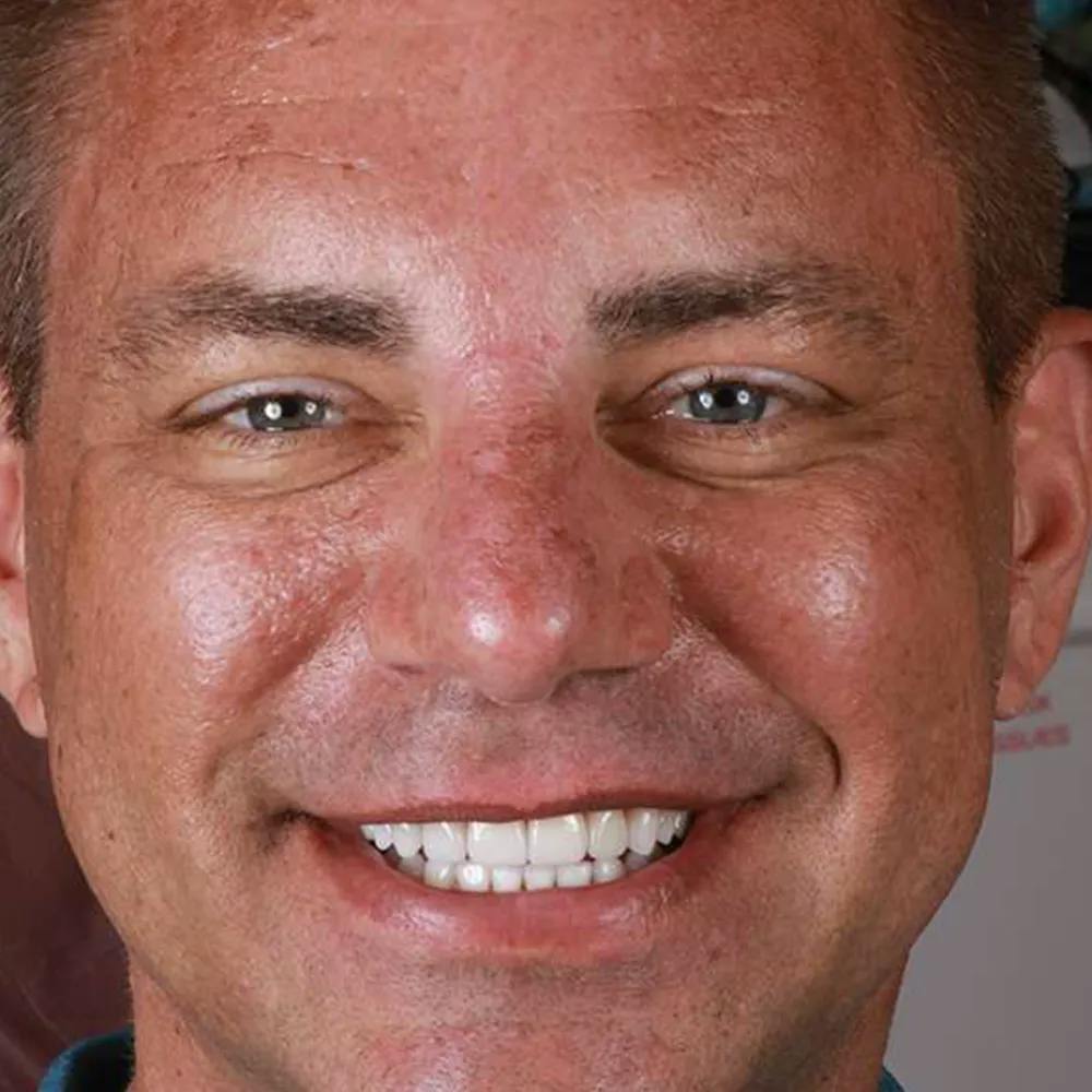 Patient twelve after