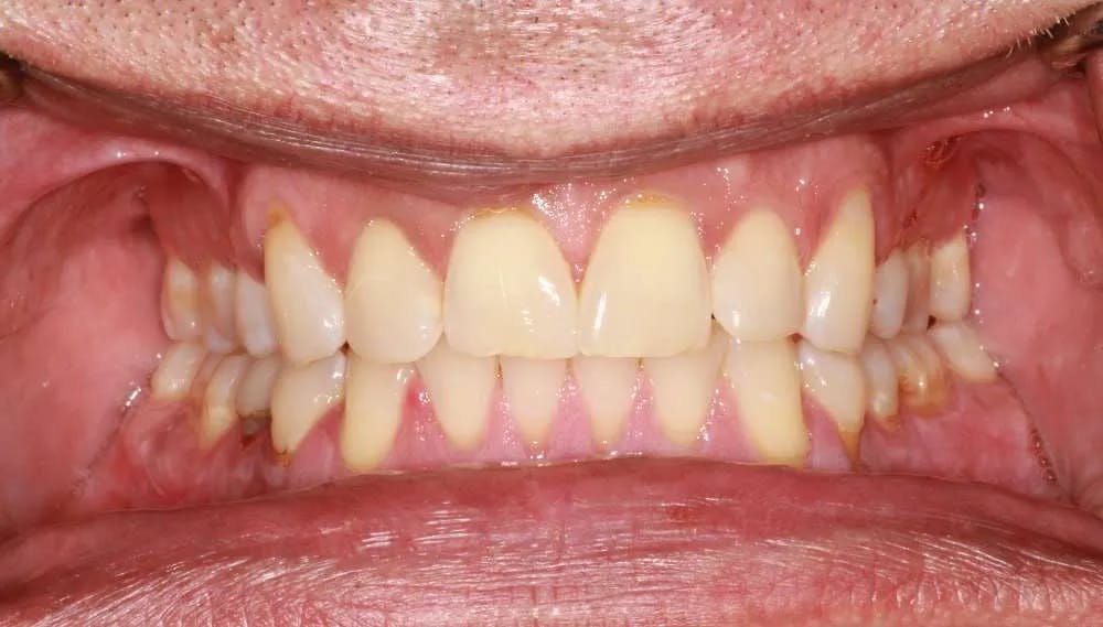 Patient twelve before and after image 1