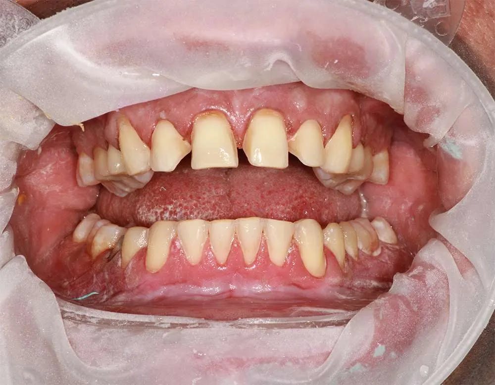 Patient twelve before and after image 2