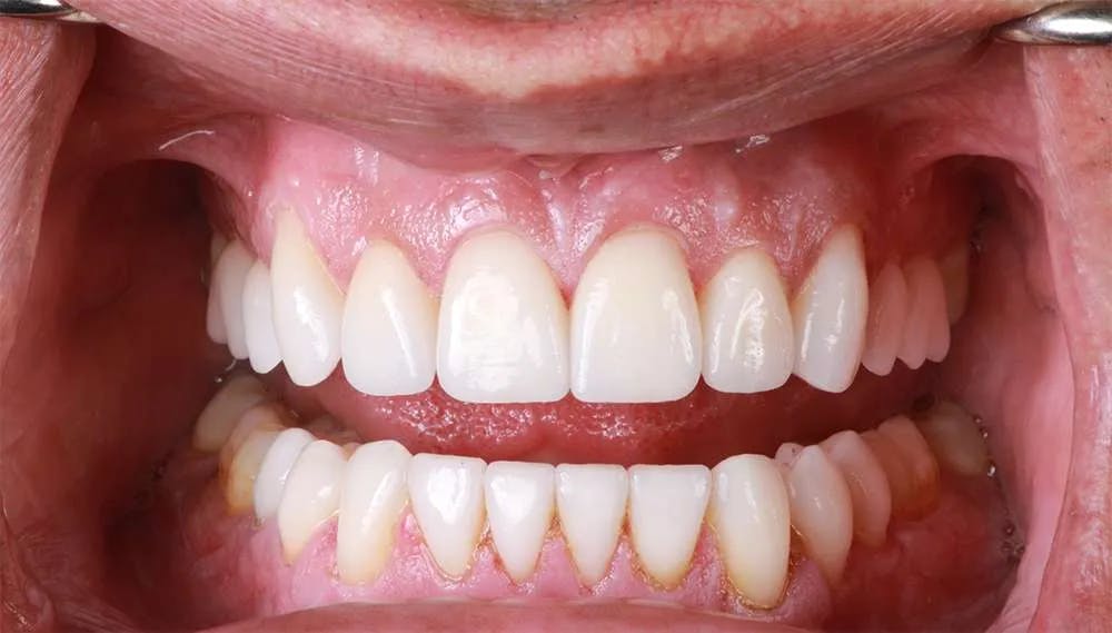 Patient twelve before and after image 3