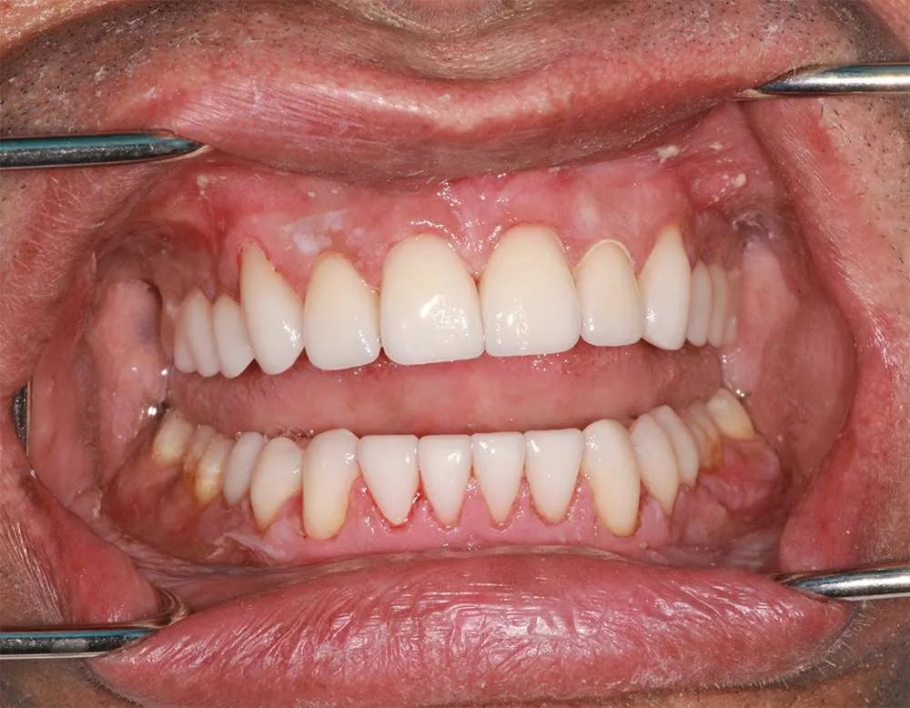 Patient twelve before and after image 4