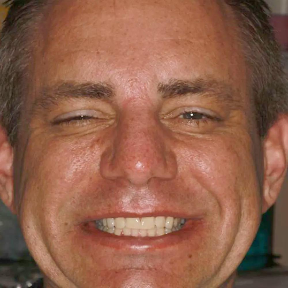 Patient twelve before