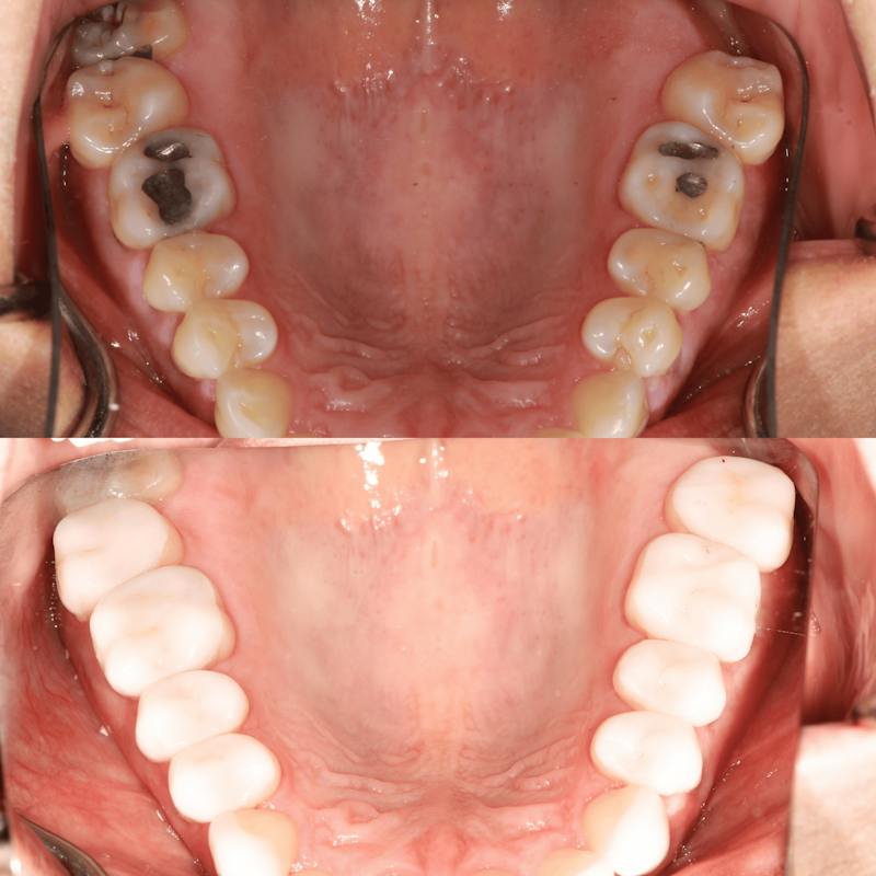 teeth