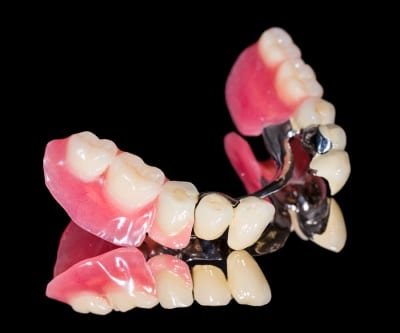 dental bridge