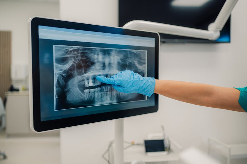 Person pointing at dental x-ray