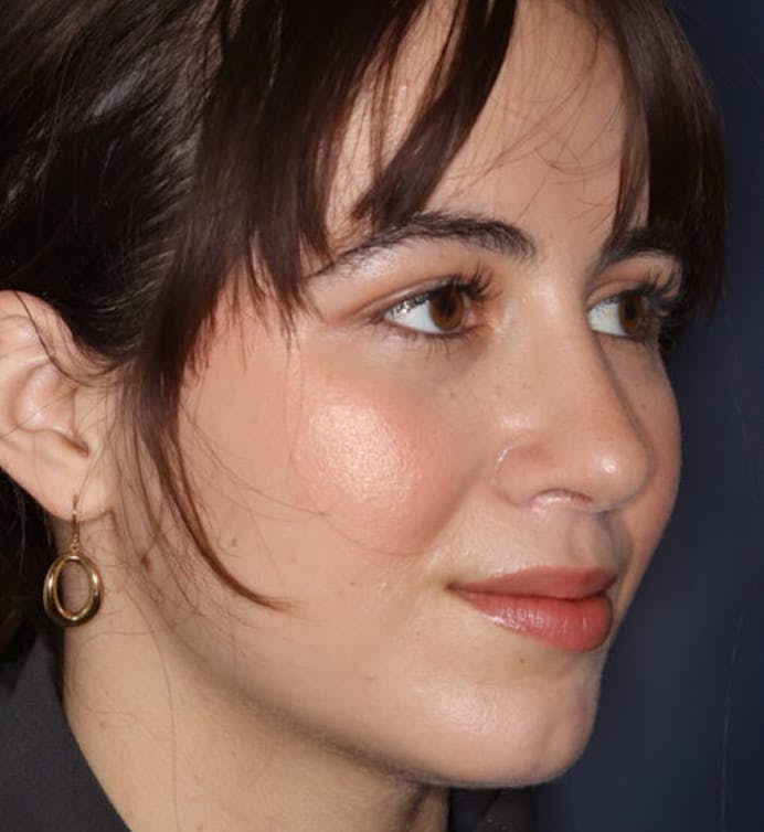 After facial treatment