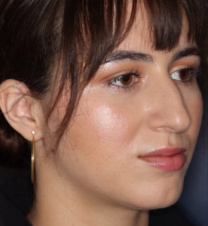 Before facial treatment