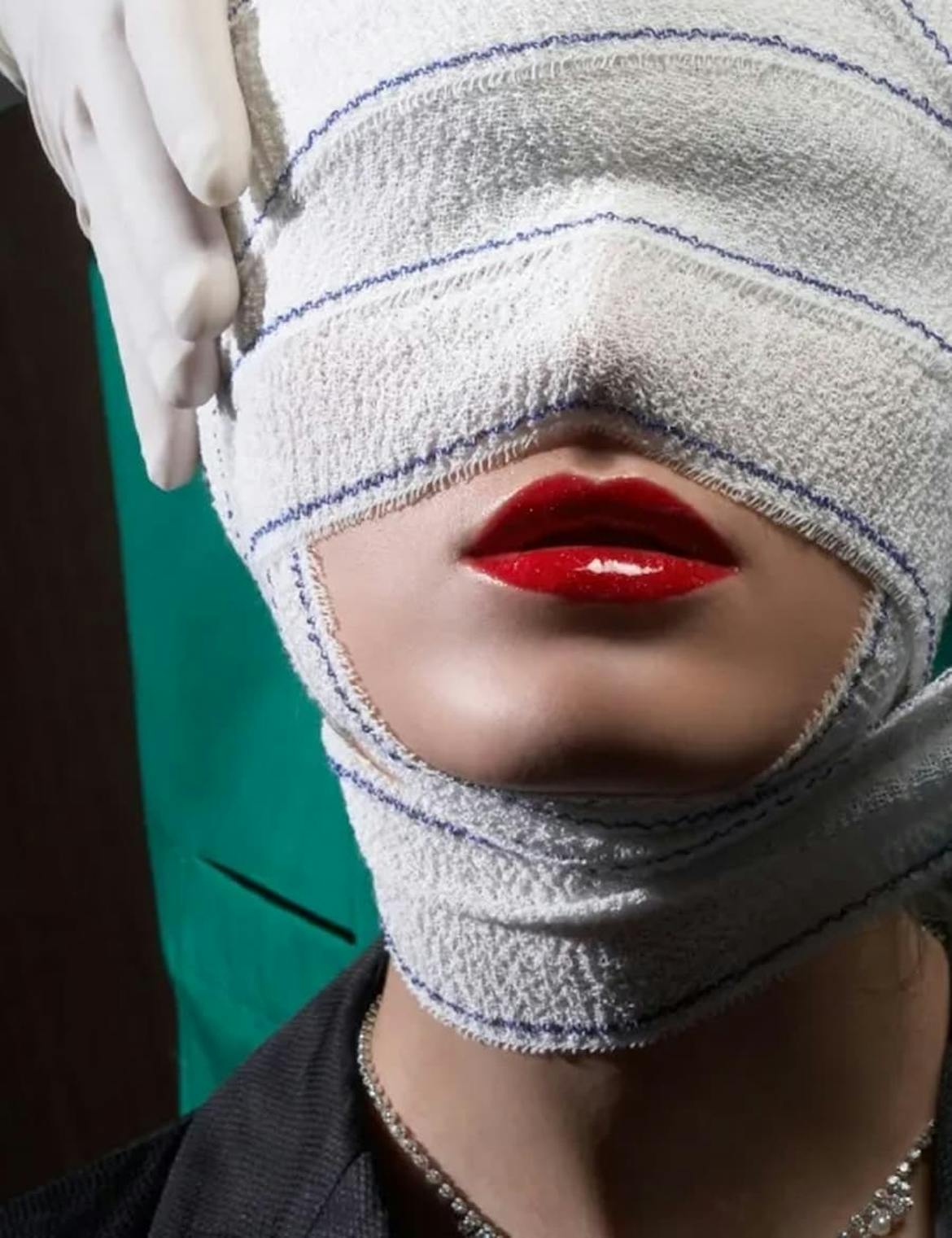 Woman with red liptick and bandages around rest of face, a surgical glove rests on the side of head
