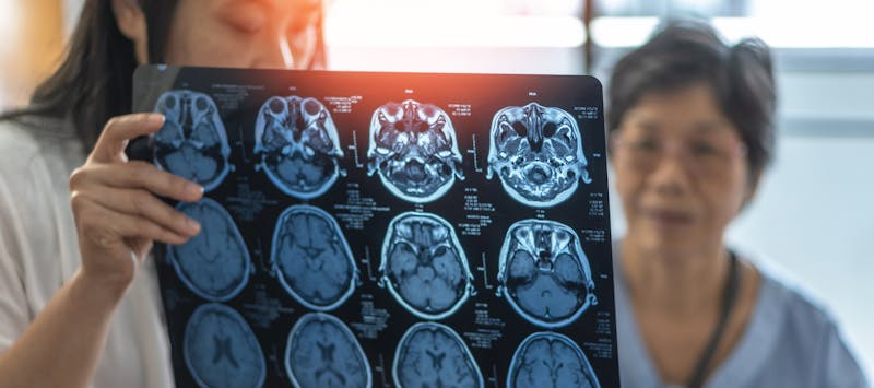 Doctor showing brain scans to a patient