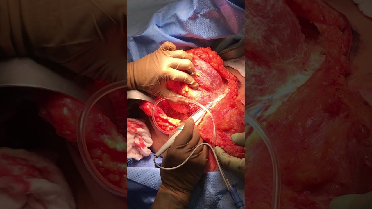 Coastal Plastic Surgeons