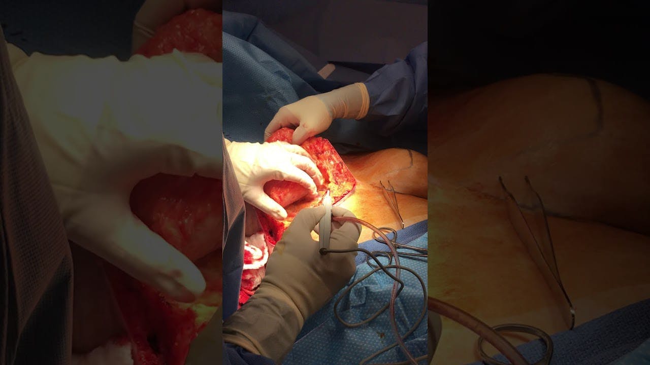 Coastal Plastic Surgeons