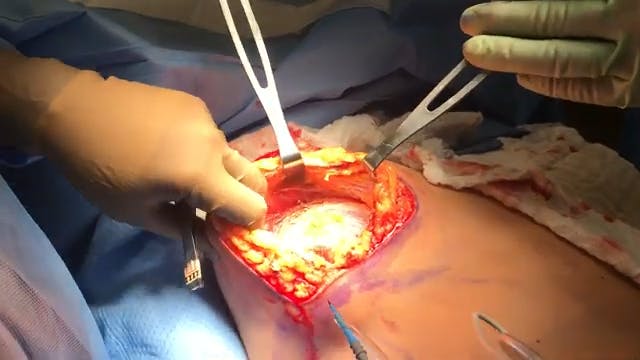 Coastal Plastic Surgeons