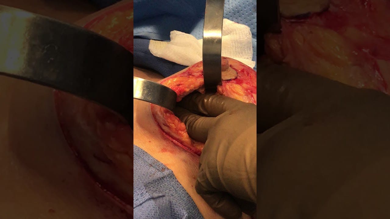 Coastal Plastic Surgeons