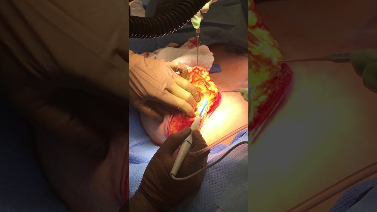 Coastal Plastic Surgeons