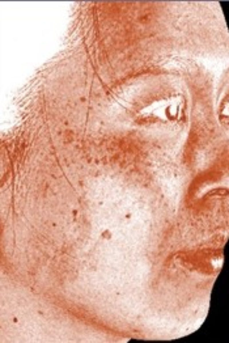 DefenAge Before & After Gallery - Patient 116120 - Image 1