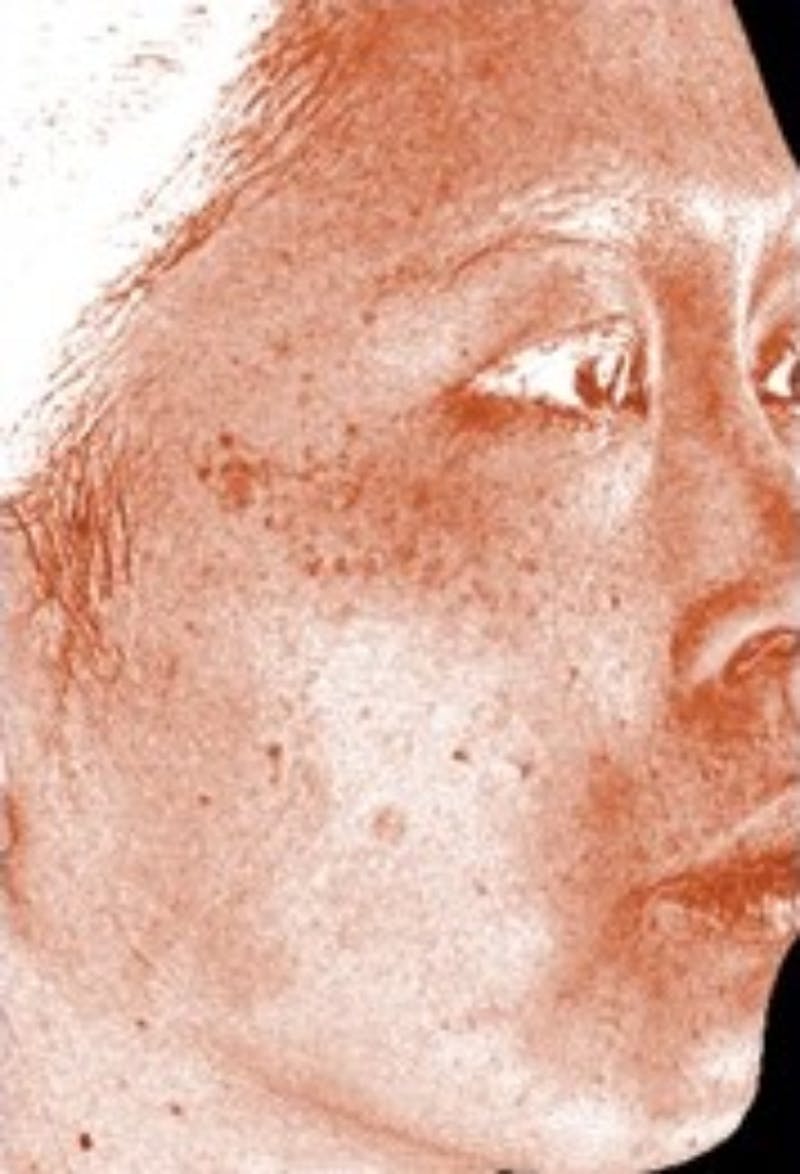 DefenAge Before & After Gallery - Patient 116120 - Image 2