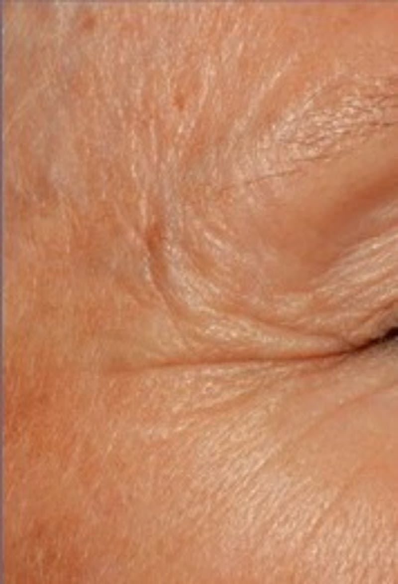 DefenAge Before & After Gallery - Patient 214149 - Image 1