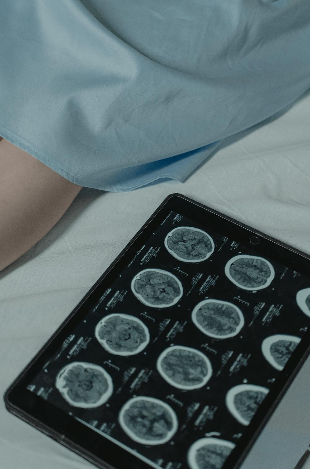 TBI may not appear on all brain scans