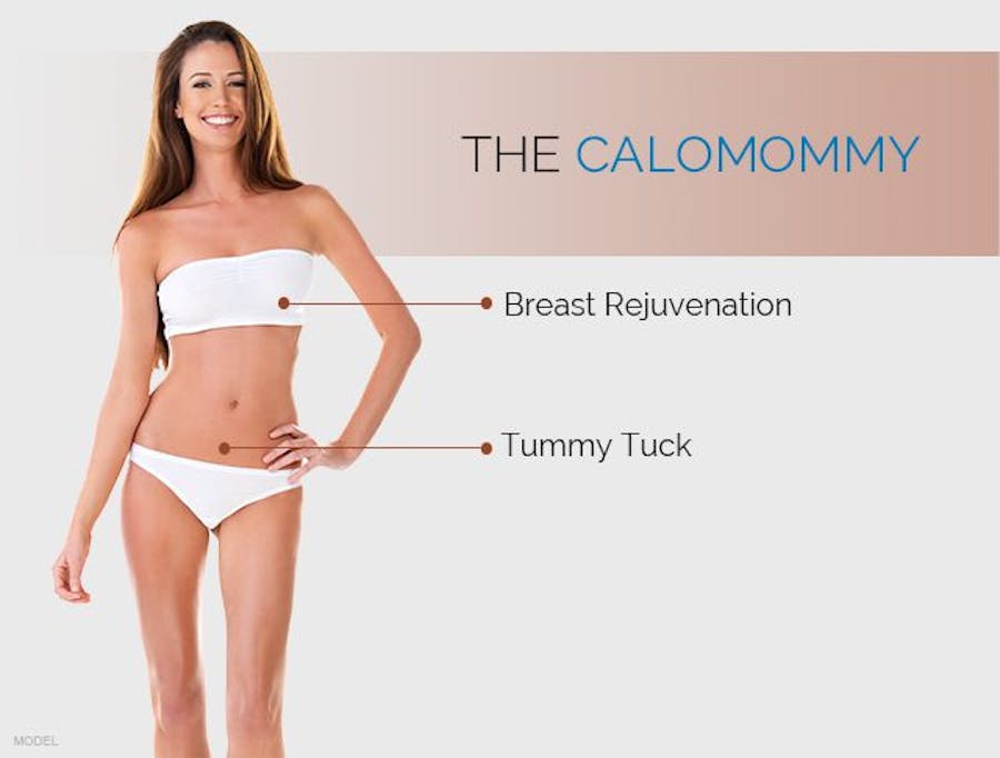 mommy makeover diagram