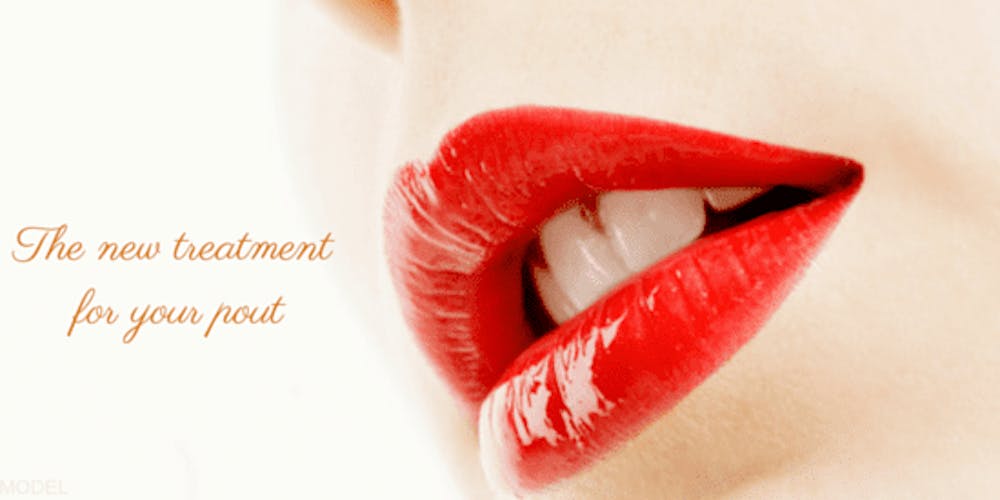 Learn about Restylane Silk, a new injectable for lip enhancement at our Kentucky practice