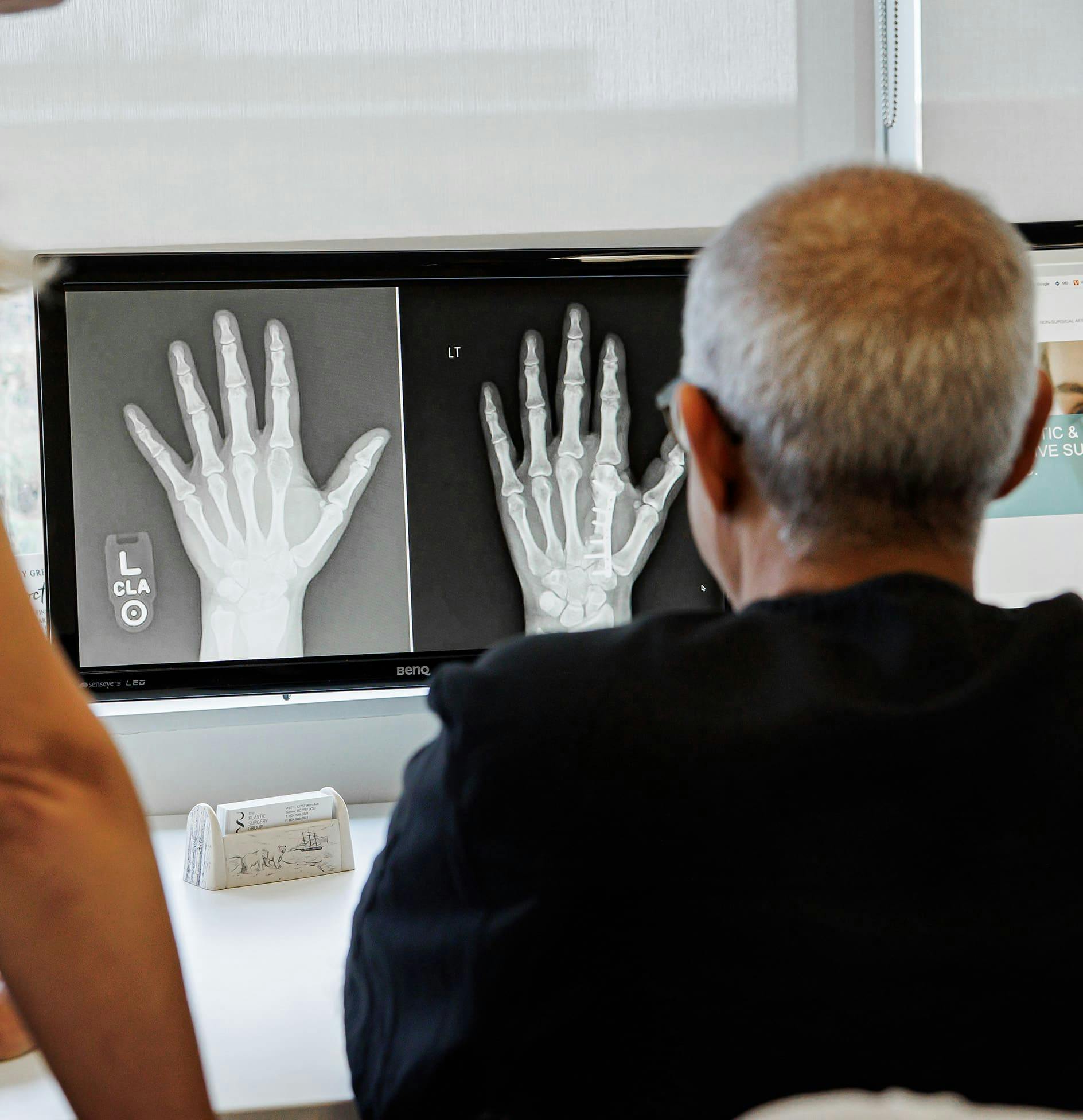 Doctor looking at xray on computer