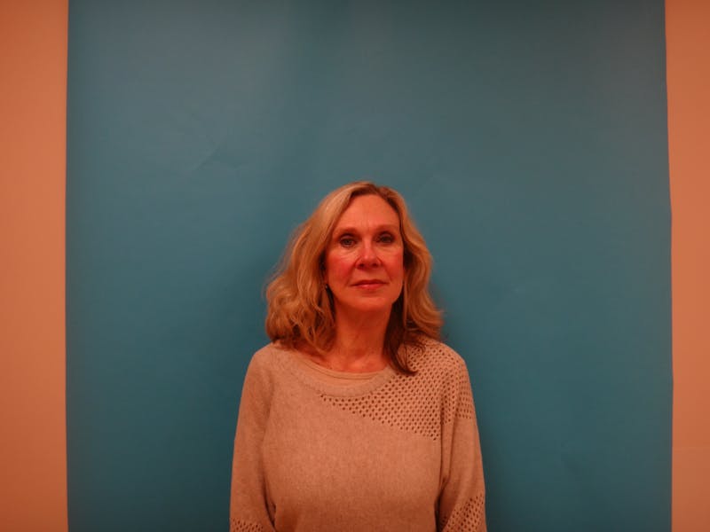 Facelift Before & After Gallery - Patient 261903 - Image 2