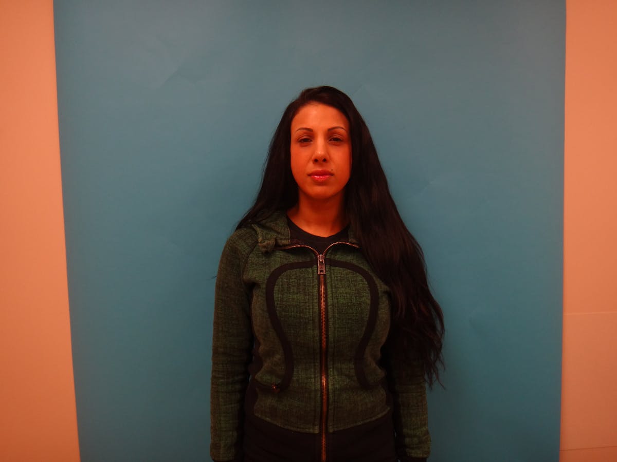 Rhinoplasty Before & After Gallery - Patient 104170 - Image 2