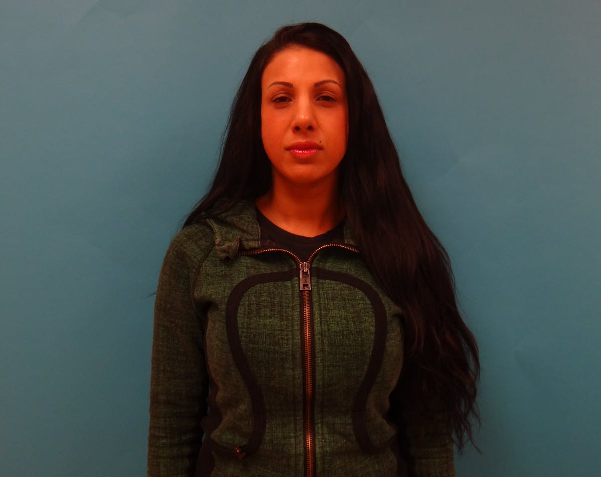 Rhinoplasty Before & After Gallery - Patient 104170 - Image 2