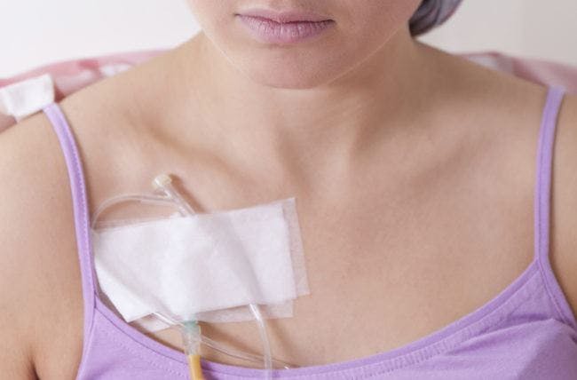 Can Metformin cause Breast Cancer?