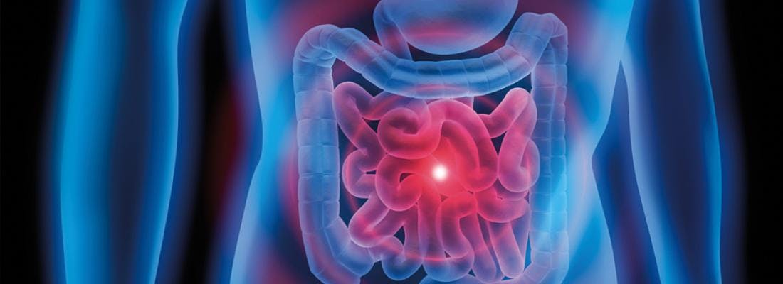 How is Belviq linked to Colorectal Cancer?