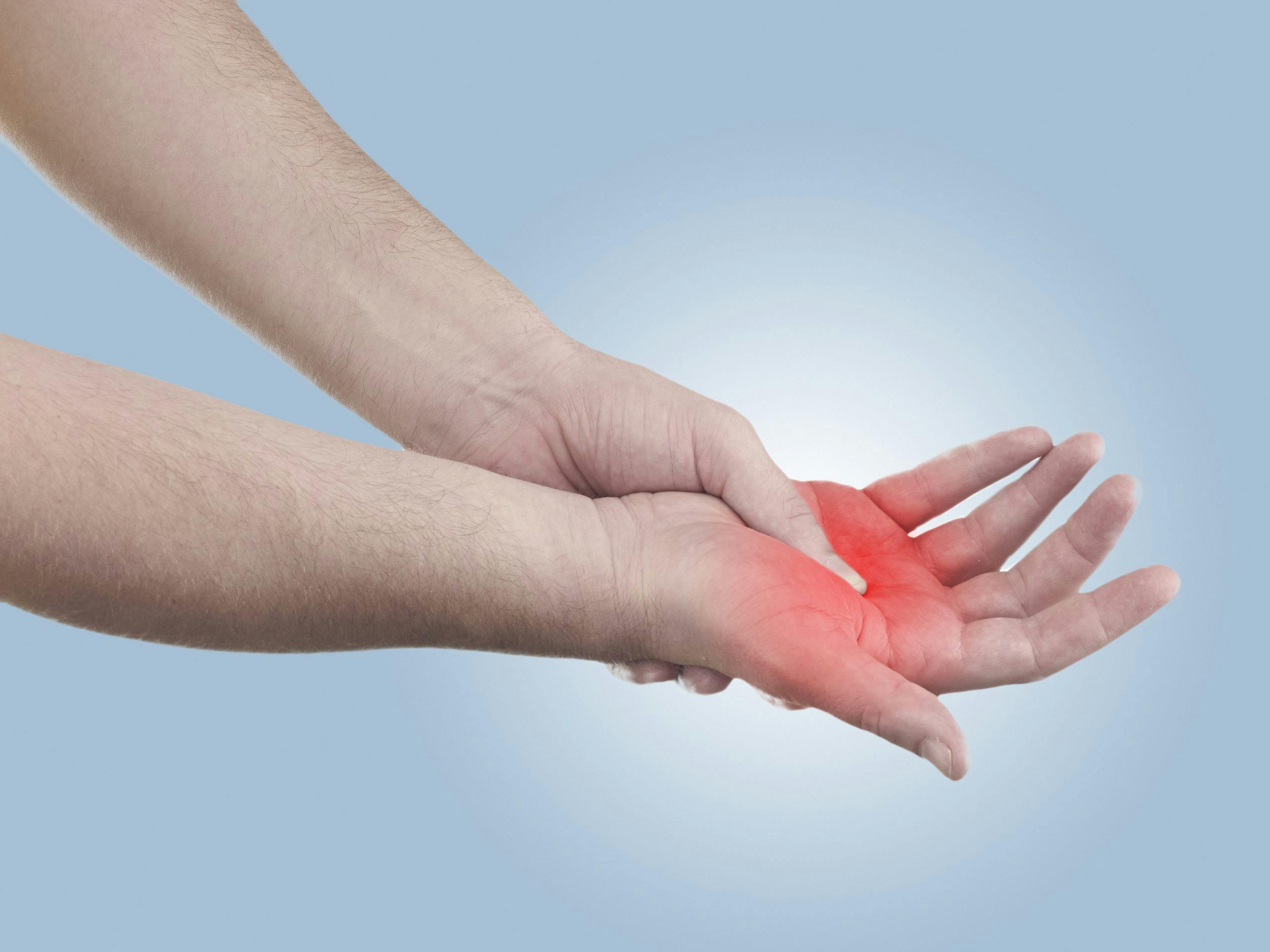 I Suffered a Coffee Burn at McDonald’s, What Are My Rights?