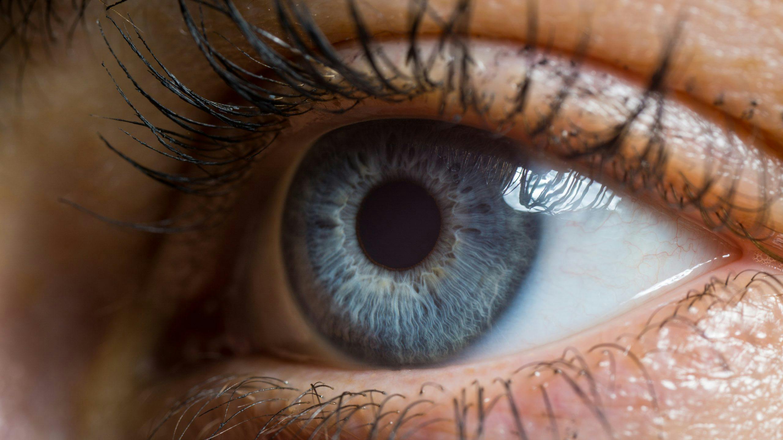 The Risk of NAION with GLP-1 Use