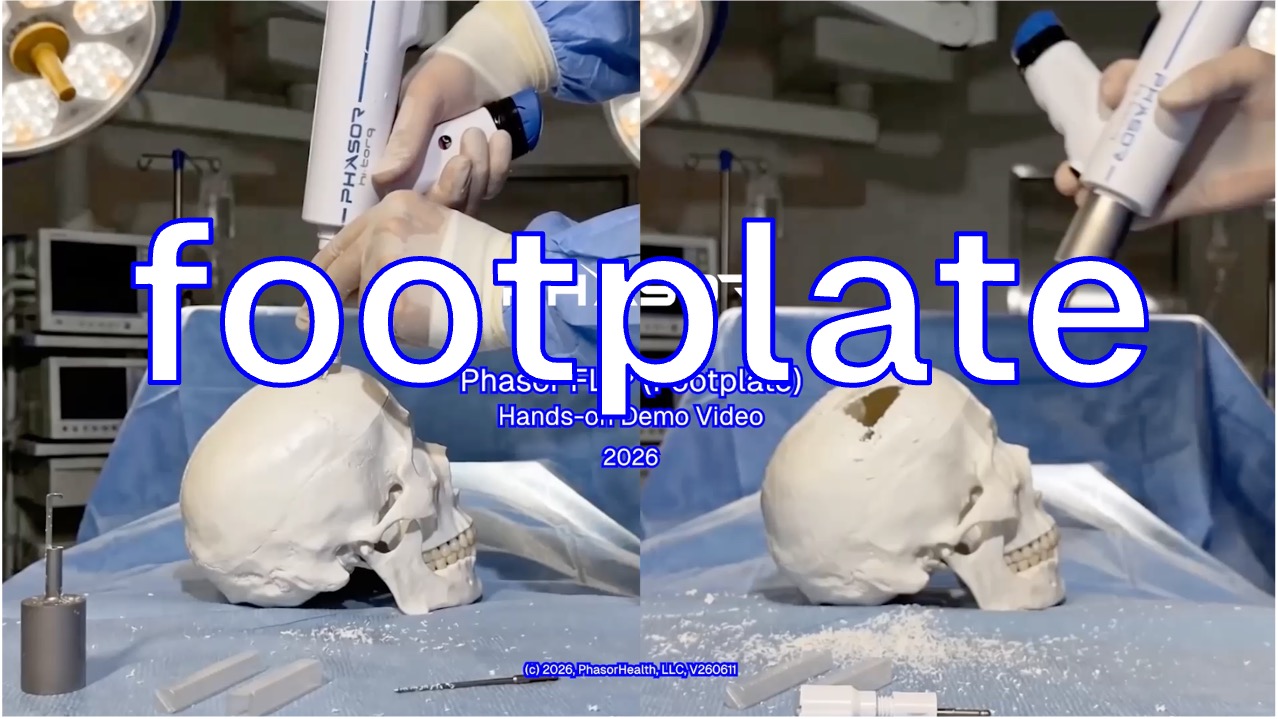 Phasor FLIP Footplate hands-on demo video