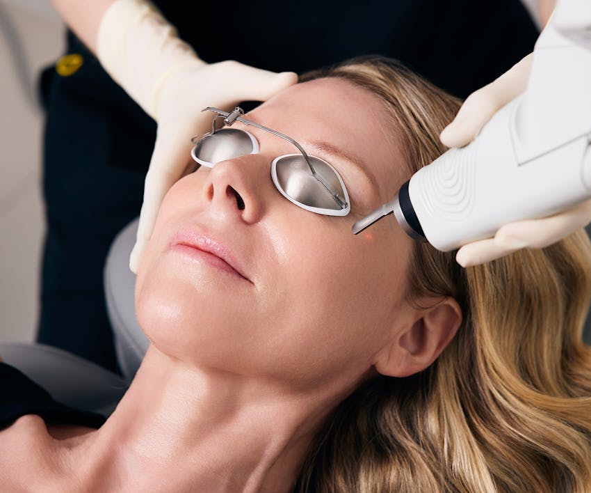woman getting laser treatment