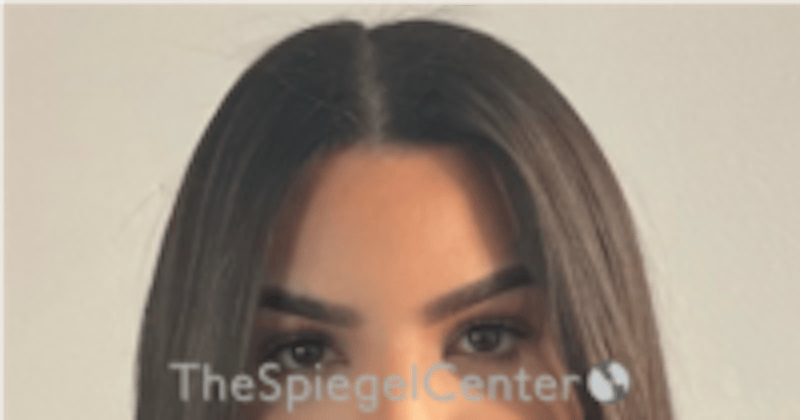 Browlift / Fox Eye Lift Before & After Gallery - Patient 152686 - Image 2