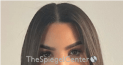 Browlift / Fox Eye Lift Before & After Gallery - Patient 152686 - Image 2