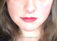 Mandible Contouring Before & After Gallery - Patient 112588 - Image 2