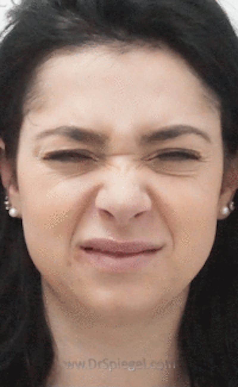 Botox / Dysport / Jeuveau / Xeomin Before & After Gallery - Patient 416771 - Image 1