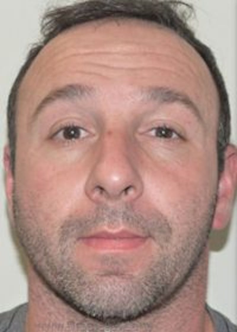 Botox / Dysport / Jeuveau / Xeomin Before & After Gallery - Patient 128613 - Image 1