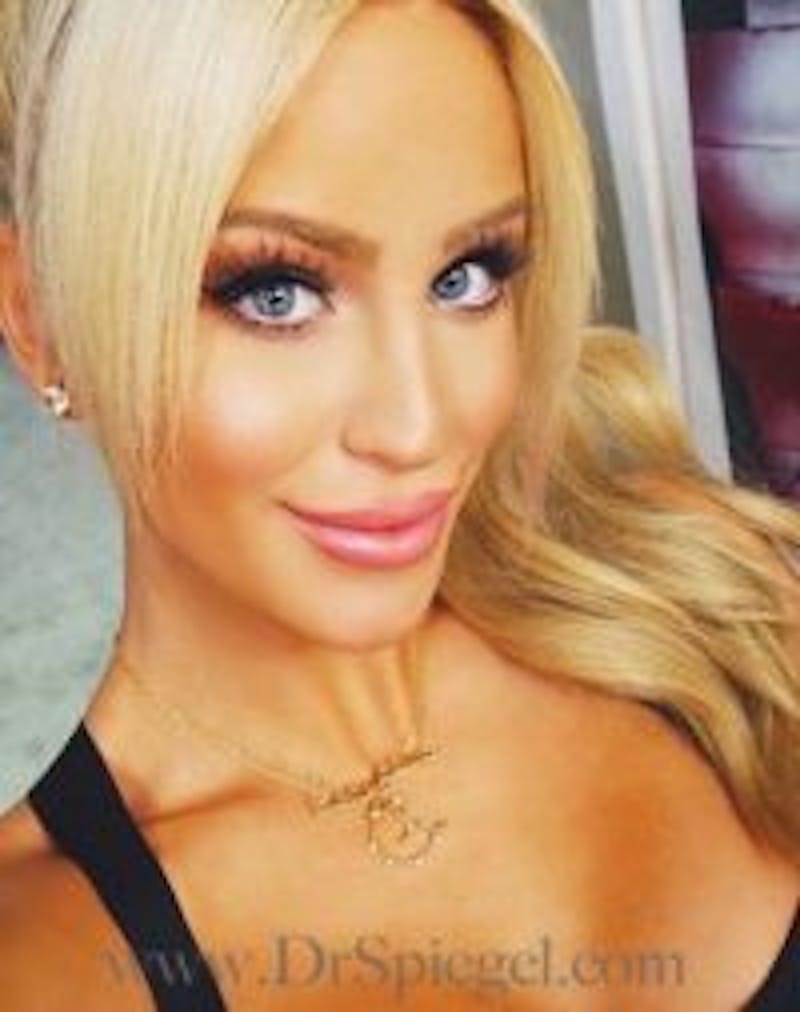 FFS Before & After Gallery - Patient 414773 - Image 3