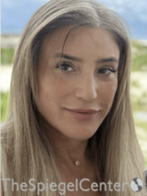 FFS Before & After Gallery - Patient 116267 - Image 2