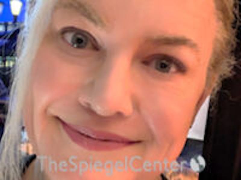 FFS Before & After Gallery - Patient 130791 - Image 3